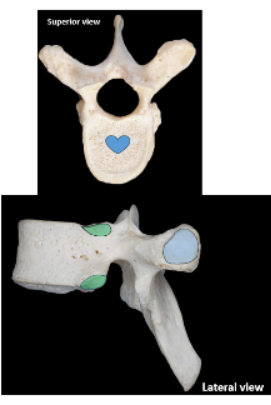 <p>Thoracic Vertebrae</p>