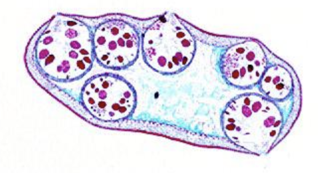 <p>This picture shows the cross section of a Fucus receptacle. Identify a conceptacle.</p>