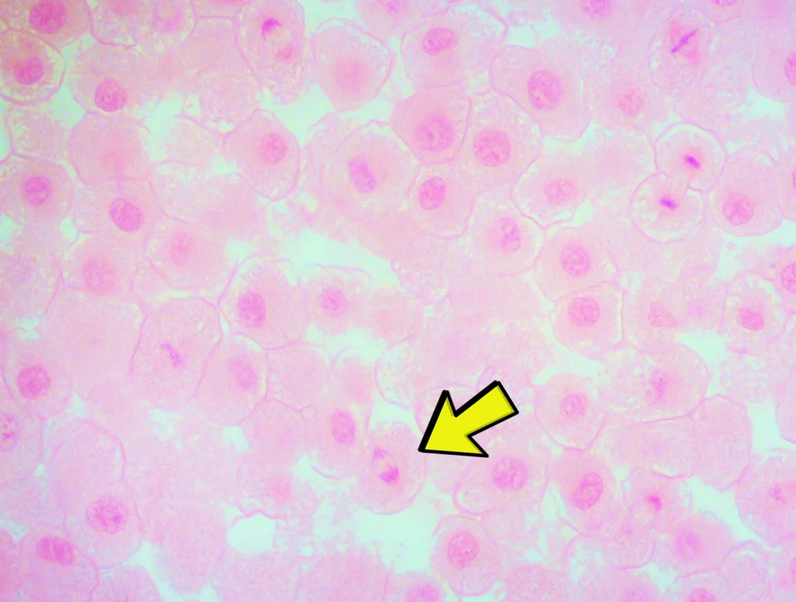 <p><span>Identify the phase of mitosis occurring at the yellow arrow.</span></p>