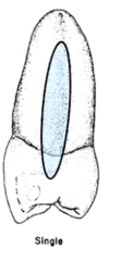 <p>- straight</p><p>- blunt apex</p><p>- mesial root concavity (longitudinal groove)</p><p>- distal root concavity (less pronounced)</p>