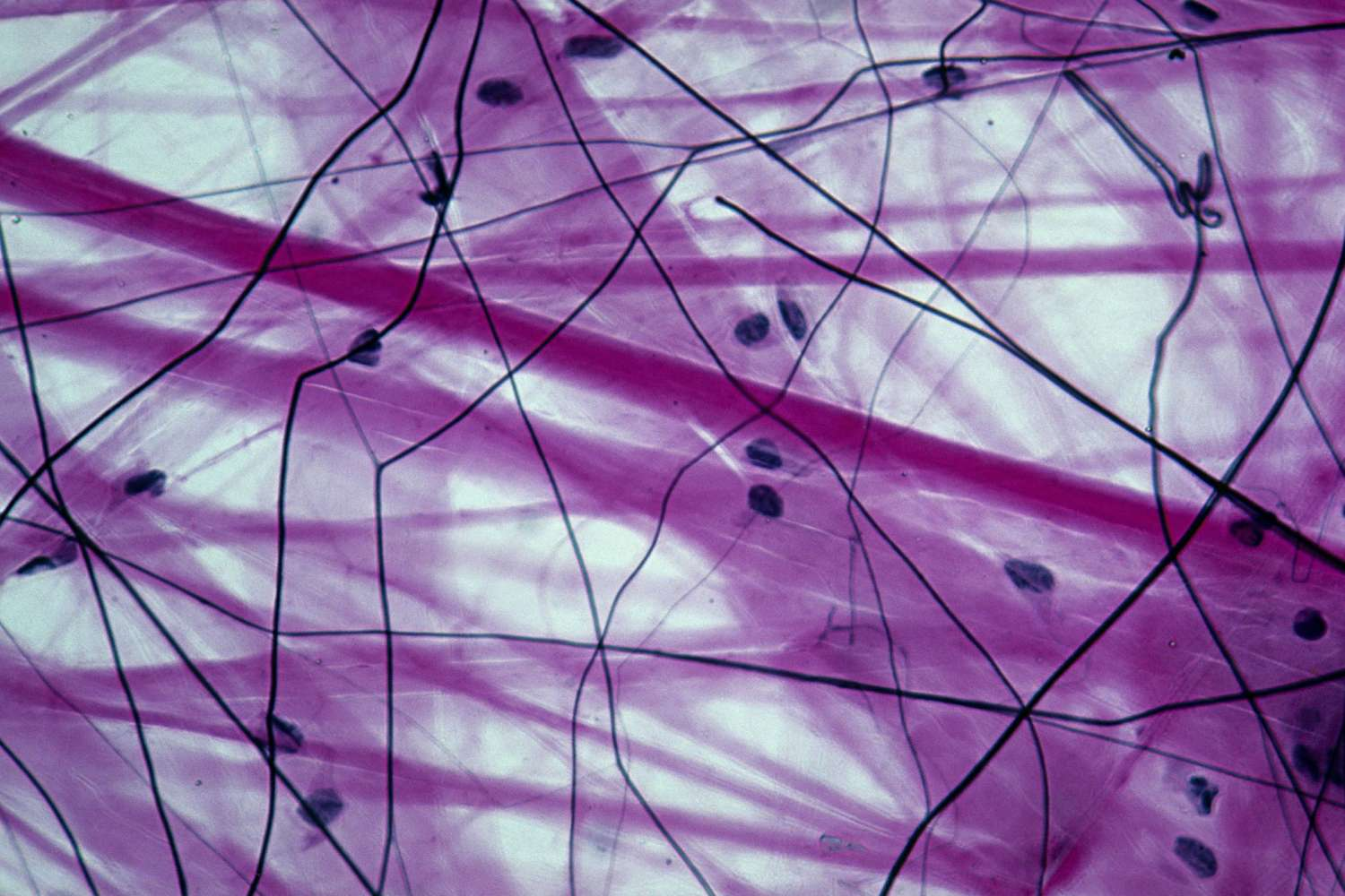 <p>Connective Tissue</p>