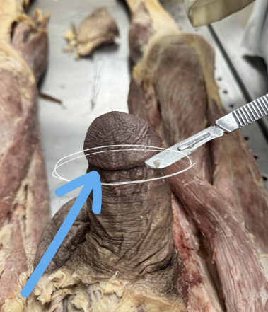 <p><span>promotes sexual arousal.</span></p>