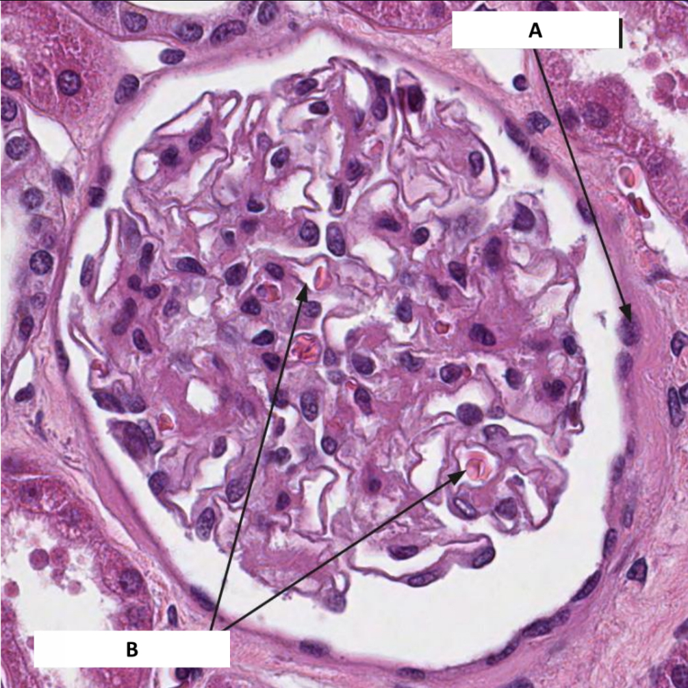 <p>Name the structure indicated by B.</p>
