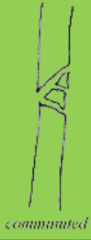 <p>fracture in more than 2 pieces</p>
