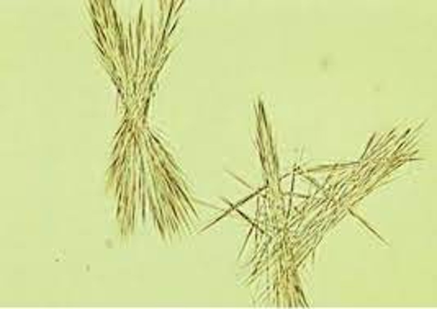 <p>Tyrosyluria</p>