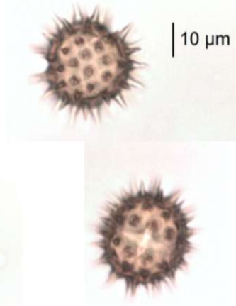 <p>Identify the pollen grains to the <strong>Family </strong>level</p>