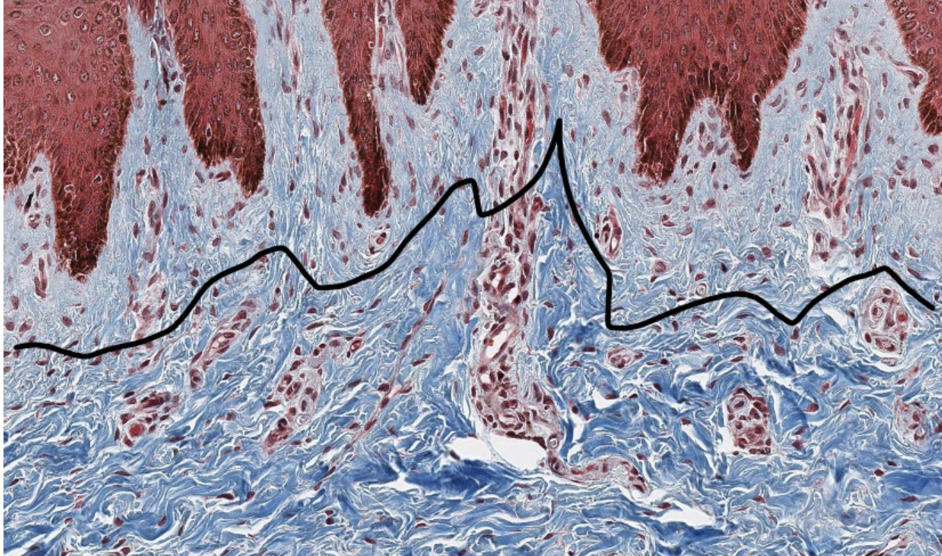 <p>The top is the ______ layer of the dermis and the bottom is the _____ layer of the dermis.</p>