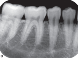 <p>Shows both light and dark areas with few shades of gray in-between</p>