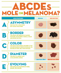 <p>Melanoma</p>
