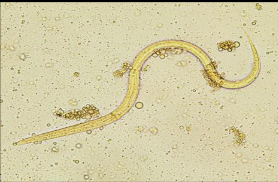 <p>Identifique e cite onde esse parasita pode ser encontrado no homem</p>