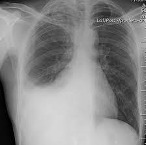 <p>Diagnosis</p>