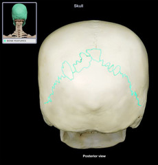 <p>What suture lies between the parietal and occipital bone?</p>