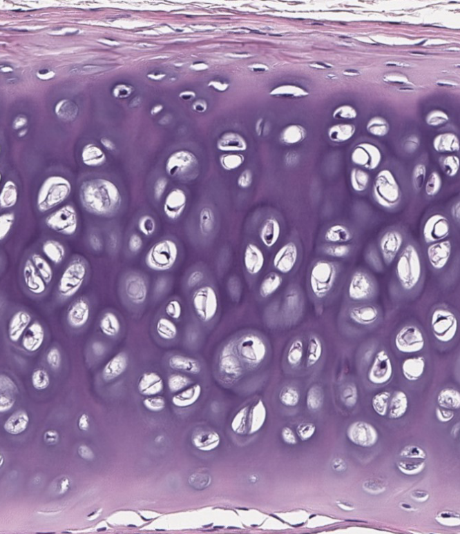 <ol><li><p>Which type of CT makes up the bulk of this image?</p></li><li><p>Does it have a perichondrium?</p></li></ol><p></p>
