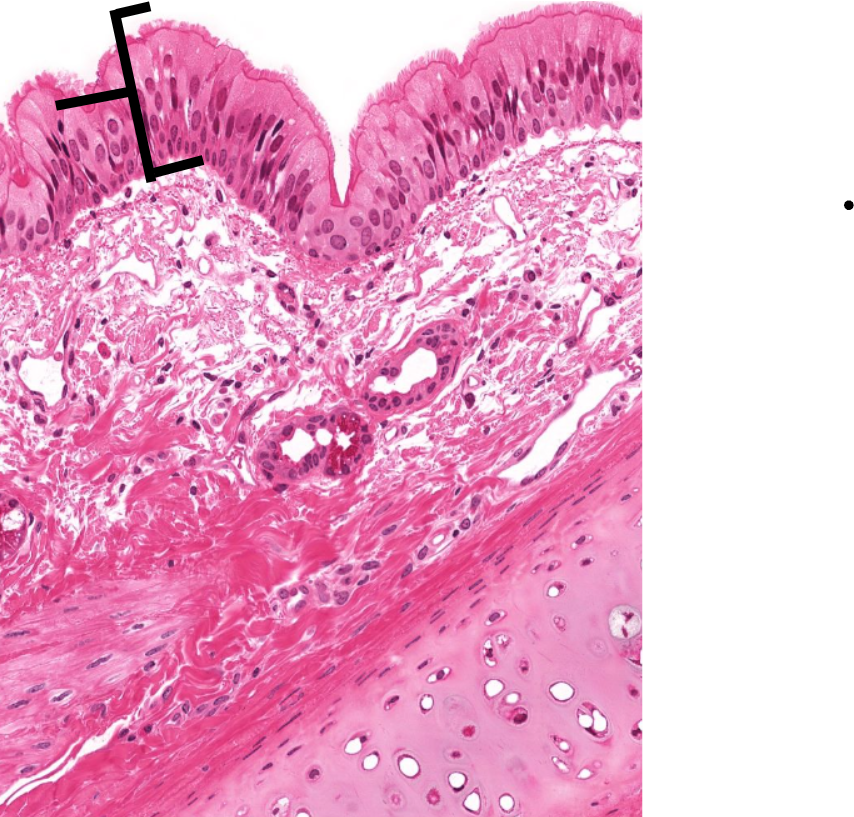 <p>What type of epithelium?</p>