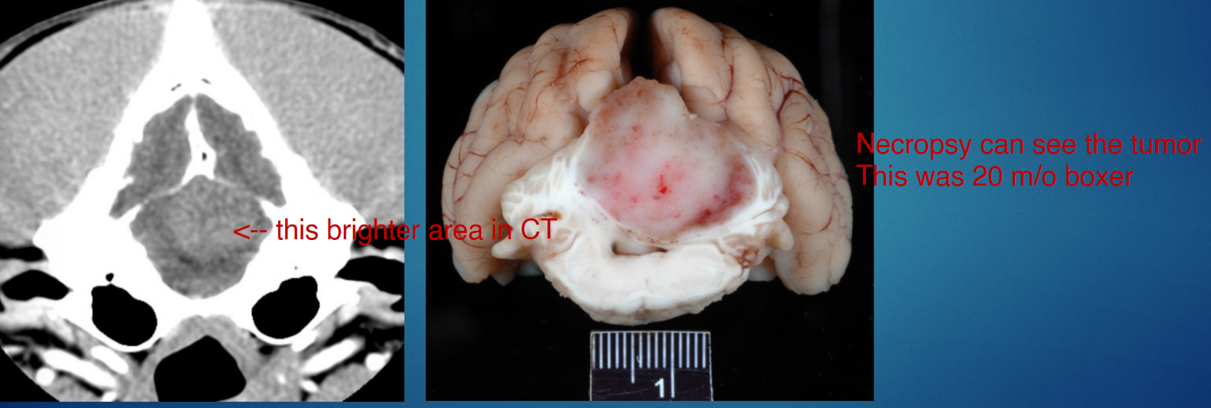 <p>1: asymmetric signs, rarely CBM signs </p><p>.</p><p>2: medulloblastomas (esp young dogs), oligodendrogliomas </p><p>.</p><p><em>note: this is VERY rare, most CNS tumors affect cerebral cortex</em></p>