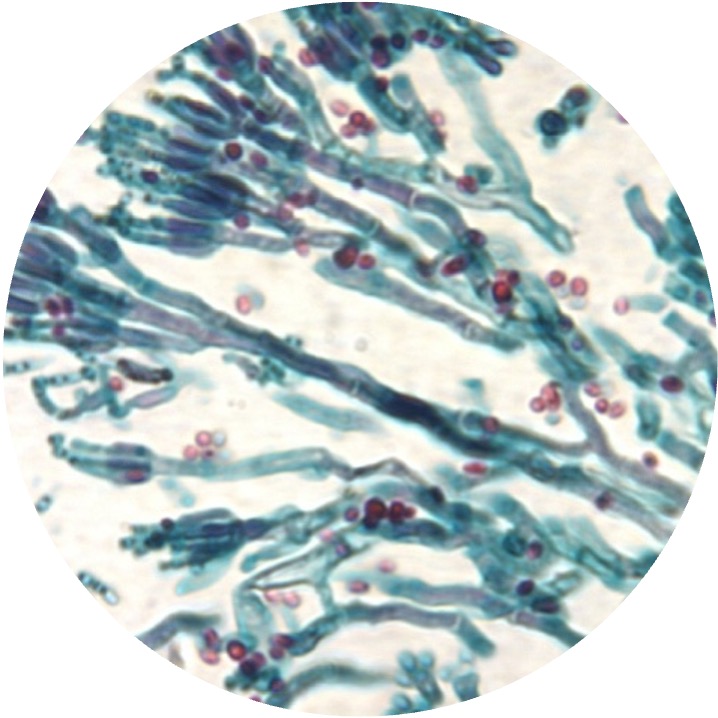 <p>This type of fungi are finger-like shaped; reproduce through phaliospores</p>