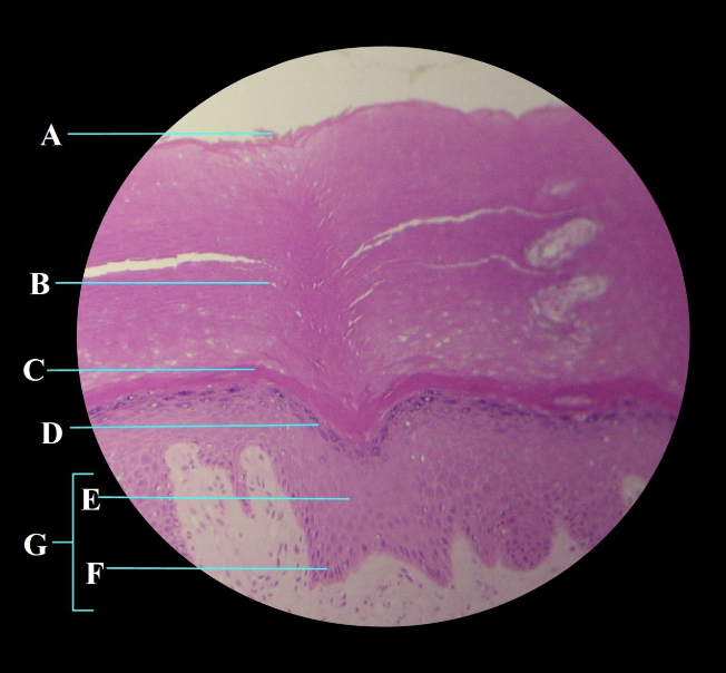 term image