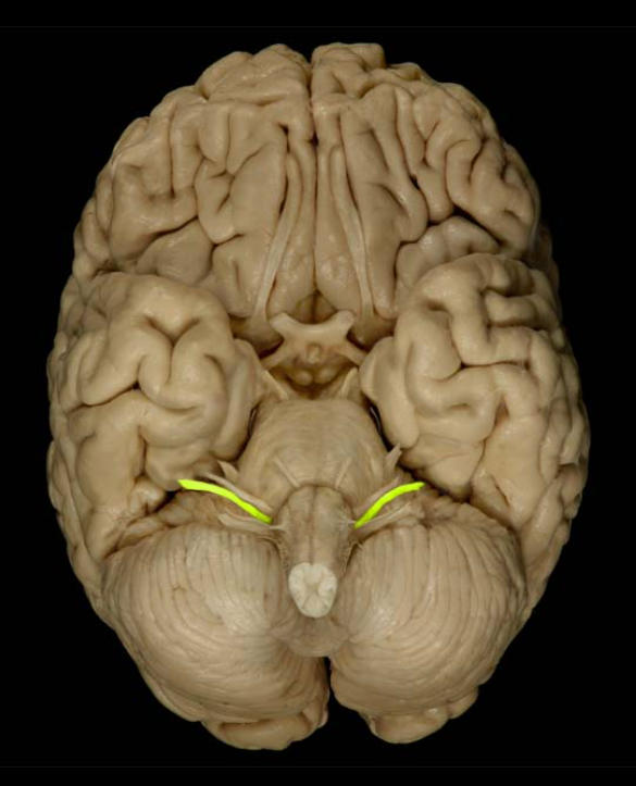<ul><li><p>formed from the Vestibular Nerve and Cochlear Nerve</p></li><li><p>composition: mixed</p></li><li><p>function: hearing and balance</p></li><li><p>damage: deafness and impaired balance</p></li></ul><p></p>