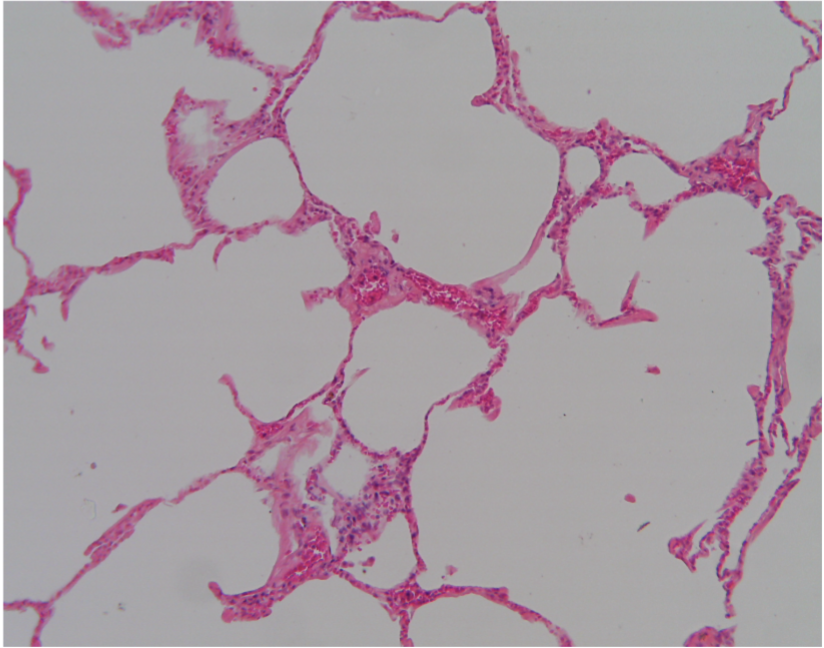 <p>What type of epithelial tissue is shown?</p>