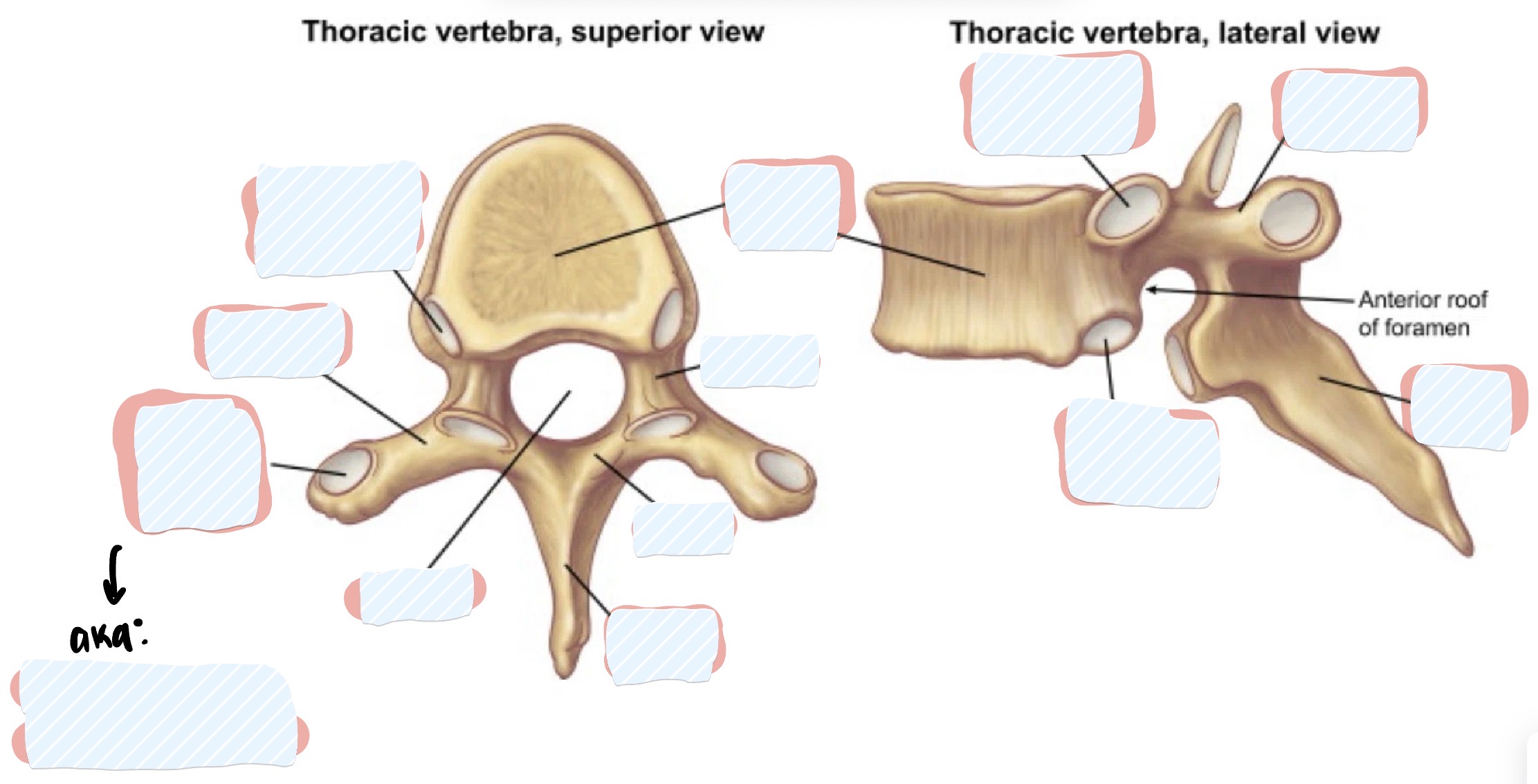 <p>Thoracic Vertebrae </p>