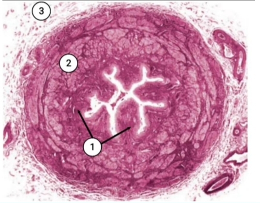 term image