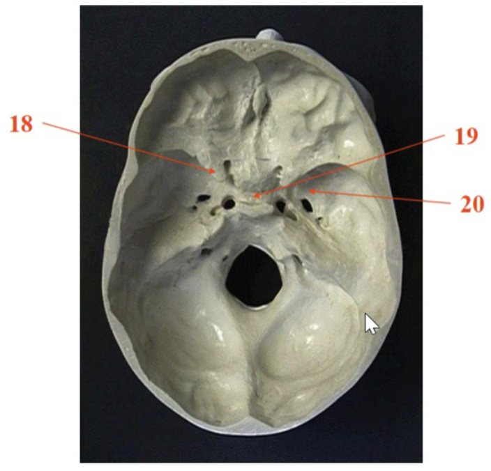 <p>18</p>
