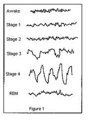 <p>non-rapid eye movement sleep; encompasses all sleep stages except for REM sleep.</p>