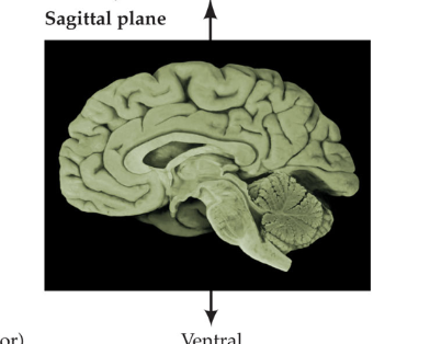 <p>divides brain into left &amp; right</p>