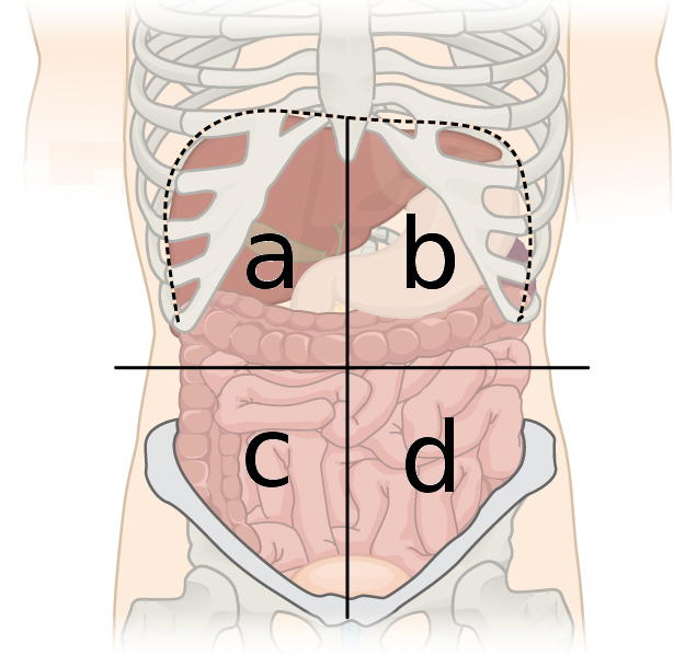 <p>A?</p>