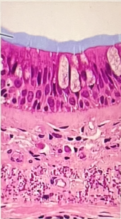 <p>which structures are highlighted?</p><p>a. microvilli</p><p>b. goblet cells</p><p>c. basement membrane</p><p>d. cilia</p><p>e. nuclei</p>