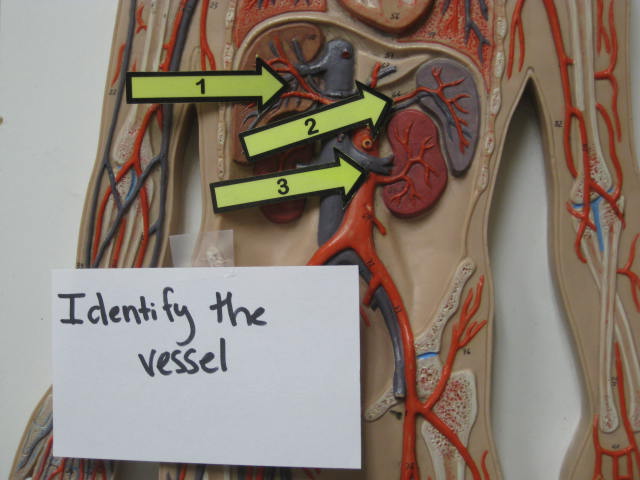 <p>Identify The Vessel 1, 2 and 3?</p><p>Lab Image 3-17</p>
