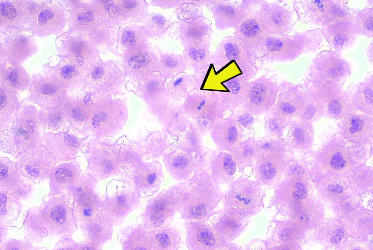<p><span>Identify the stage of the cell cycle that occurs in addition to the phase of mitosis seen at the yellow arrow of the micrograph..</span></p>