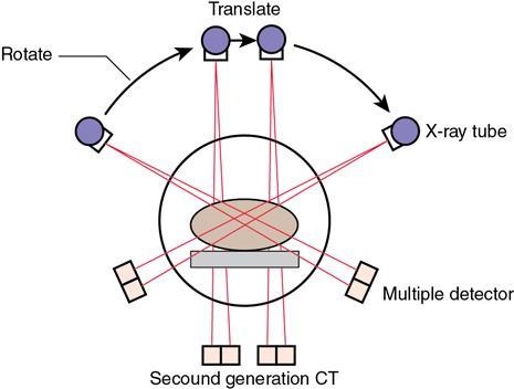 <p>Second Generation CT Scan</p>