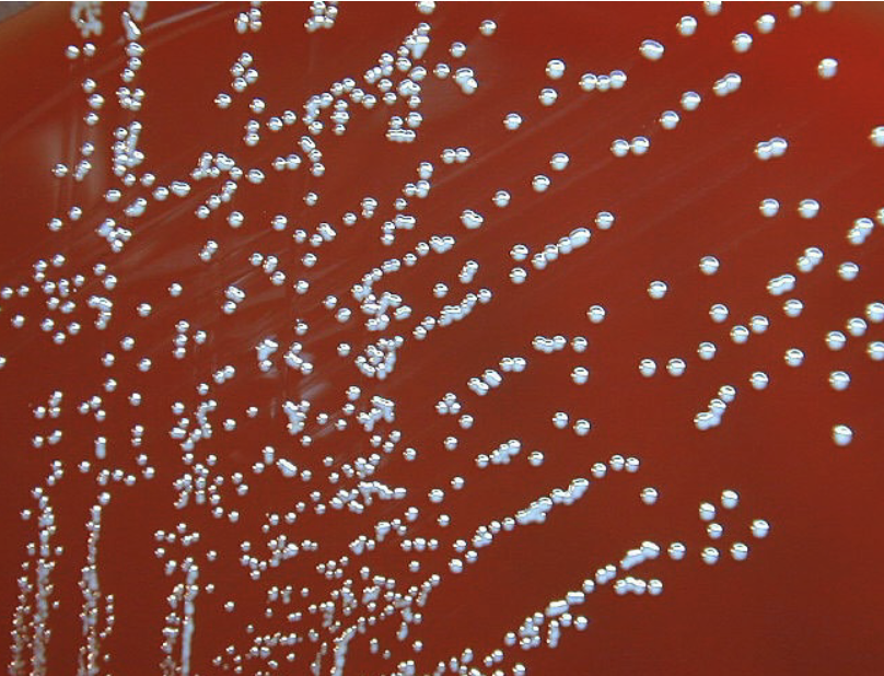 <p>brucella species demonstrate a ____ colony form associated with the presence of small capsule and virulence</p>