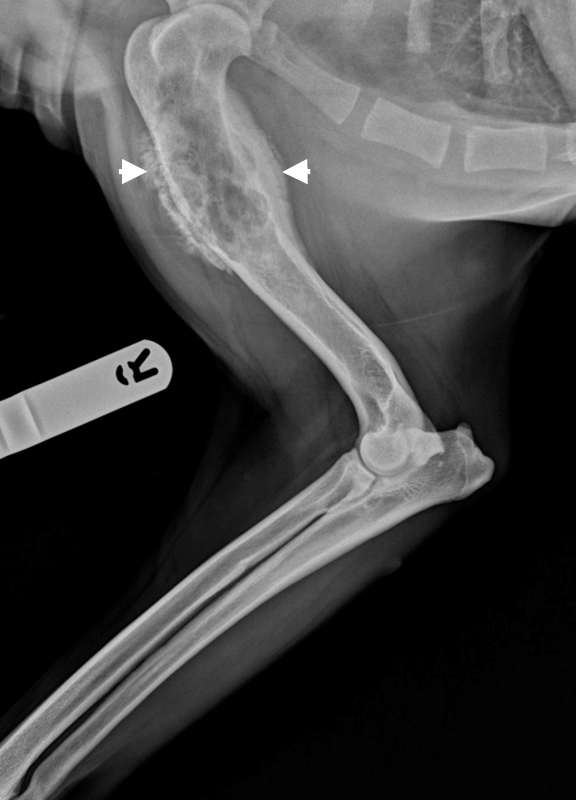 <p>OSTEOSARCOMA</p>