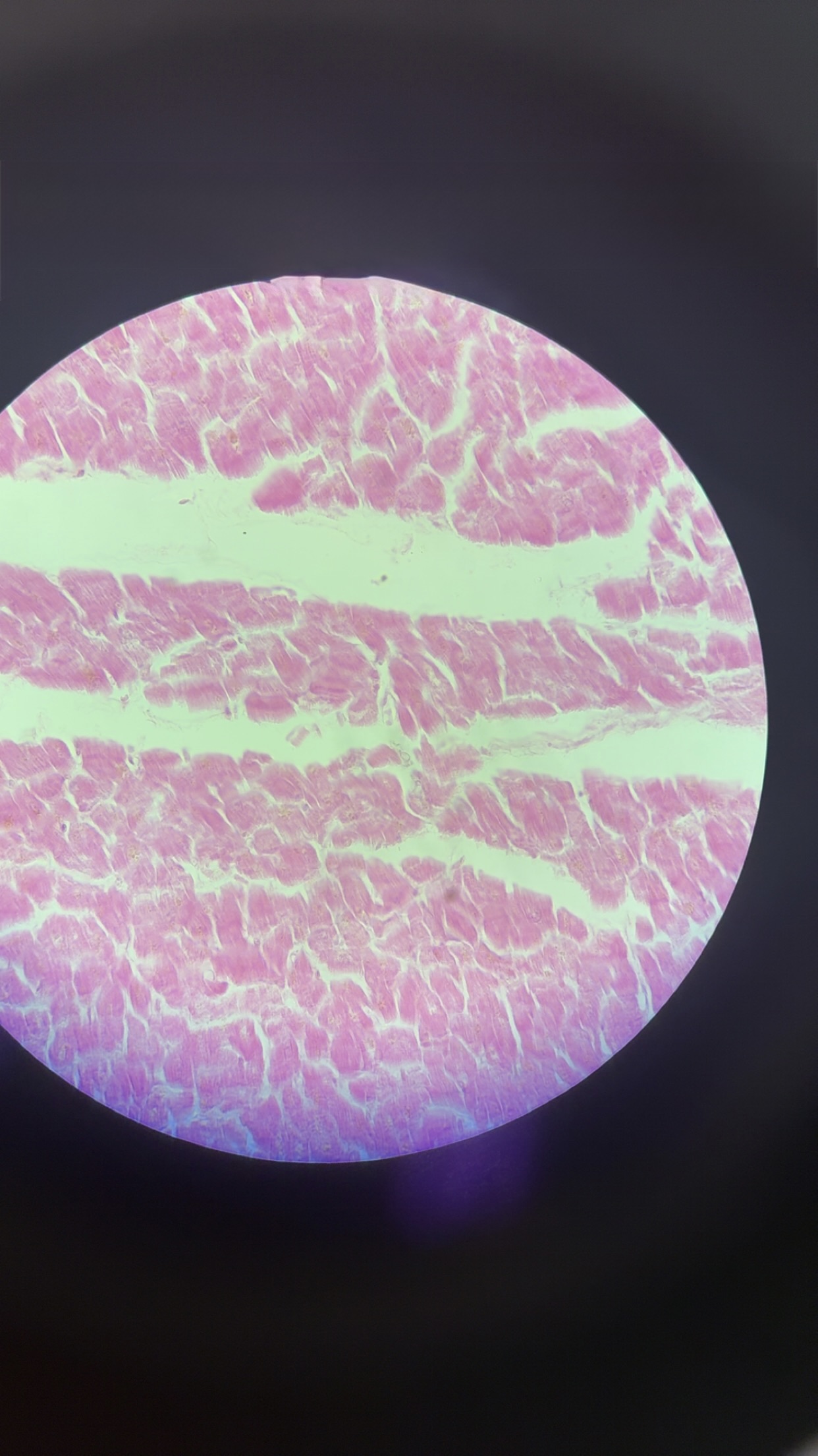 <p>what kind of muscle </p>