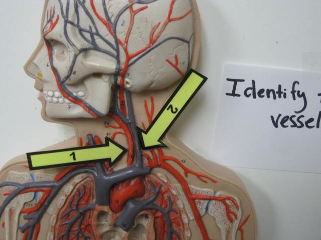 <p>Identify The Vessel 1 and 2?</p><p>Lab Image 3-6</p>