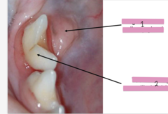 <p>What is structure 1?</p>