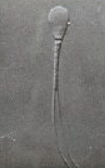 <p>What is this? Normal or abnormal sperm?</p>