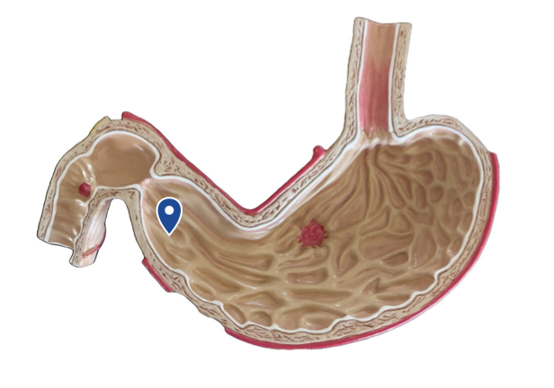 <p>Name this region of the stomach.</p>