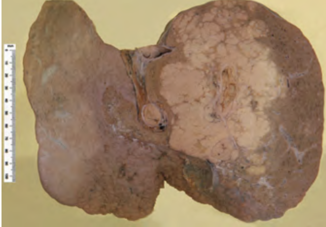 <p>Identify the POT</p>