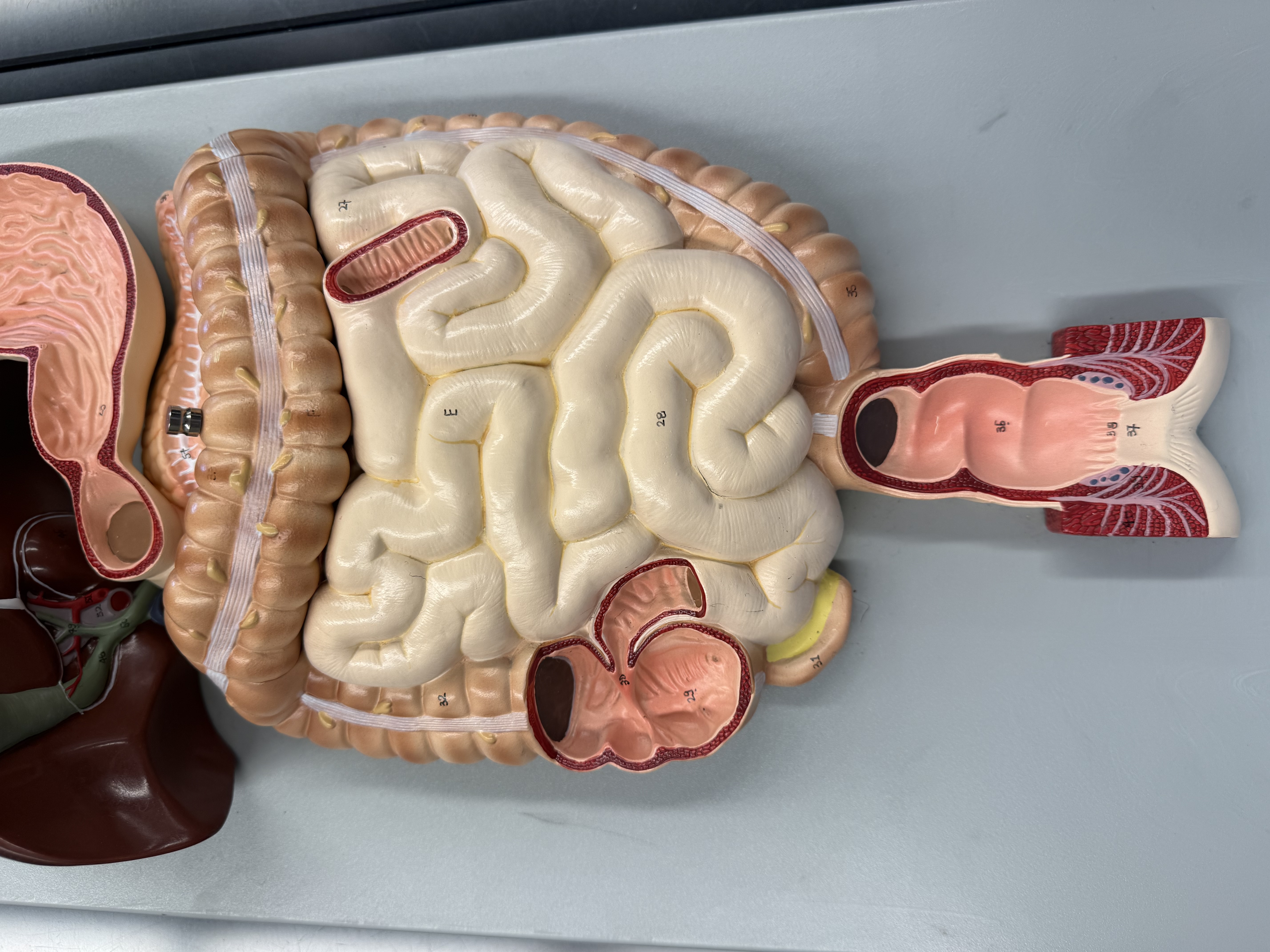 <p>right side of large intestine</p>