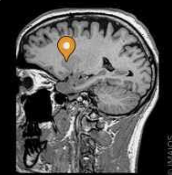 <p>Name this part of the brain</p>