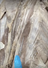<p>Name the Muscle</p><p>- I Love Science</p><p>- ILS lateral to medial</p>