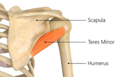 <p>Lateral border of scapula</p>