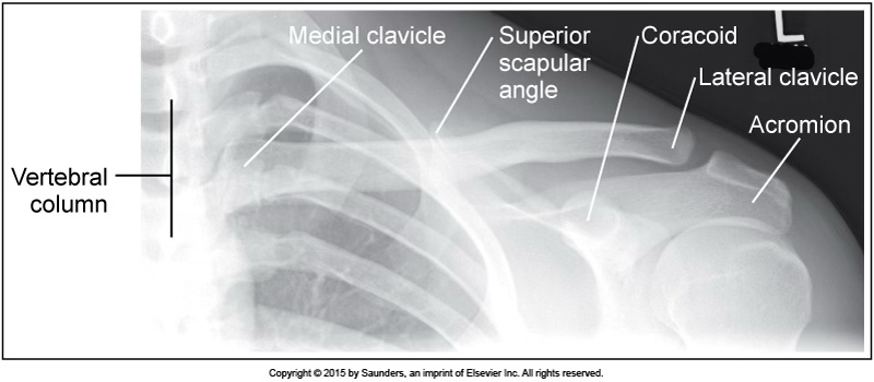 <p>AP clavicle</p>