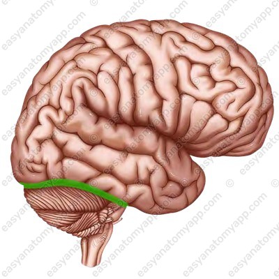 term image