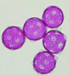 <p>Type of pollen? </p>