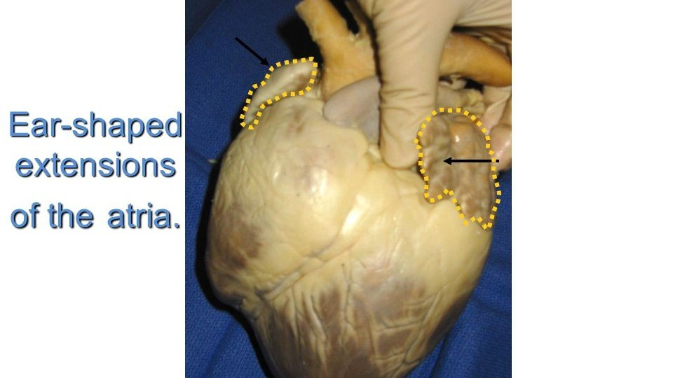 <p><u>Auricles</u>, which are small, ear-shaped structures on the top of the heart that are remnants of the fetal heart structure.  </p>
