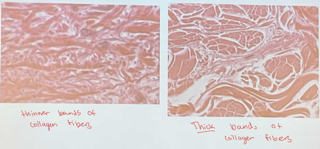 <p>Which is loose aerolar CT and which is dense irregular CT ?</p>
